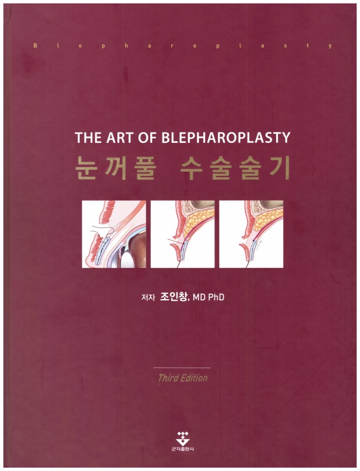 特価品セ of Art 裁断済❗️韓国の眼瞼手術の名著❗️The
